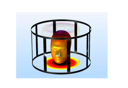 سیم‌پیچ قفسه MRI