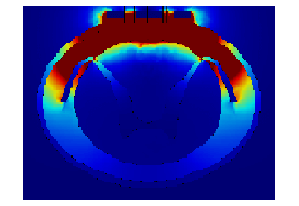 ماهیت درد چیست؟