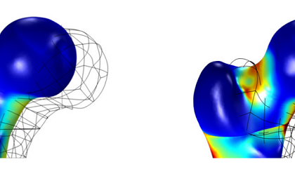 مدلسازی استحکام استخوان با استفاده از مواد همسانگرد و ناهمسانگرد